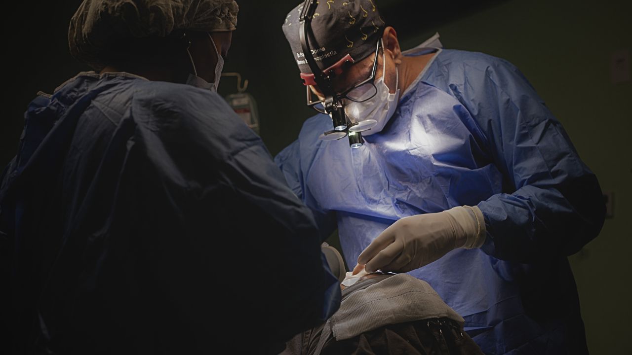 Rinoplastia em Nariz Negróide em Salvador - Dr. Paulo Dórea